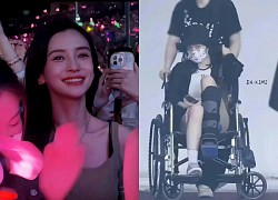 Angelababy and Chinese stars were &quot;boycotted&quot; for attending the BLACKPINK concert, Cheng Tieu arrived in a wheelchair?