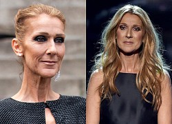 Celine Dion is in a state of &quot;alarm&quot; because of a serious illness, the audience prays for a miracle?