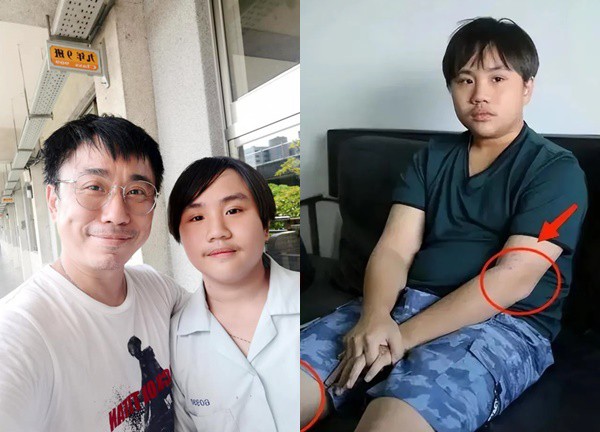 Tiểu Tiểu Bân: Thần đồng diễn xuất, bị cha ruột xem như "ATM di động", giờ làm nhân viên vệ sinh