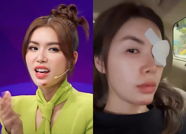 Minh Tú lộ ảnh vào bệnh viện, mặt băng bó, vận xui tiếp tục đeo bám nữ người mẫu?