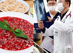 Processing pork, often eating blood soup: the man has multiple organ failure, purple veins all over his body