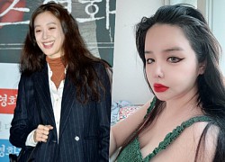 Từ Park Bom đến Hong Soo Ah: "Những ngôi sao bị hủy hoại vì phẫu thuật thẩm mỹ"