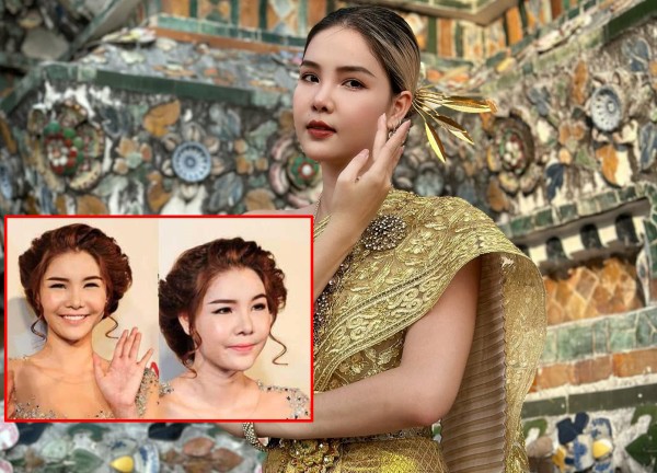 Kỳ Hân: Từng sợ Mạc Hồng Quân bỏ khi khuôn mặt biến dạng