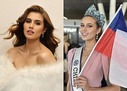 Miss World 2024: Miss candidate revealed, terrible profile, suffering from strange syndrome