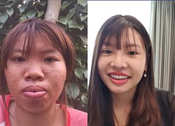 "Thi No" Quach Phuong after 6 years of "smashing her face to rebuild": Through 1 husband, becoming a mother of 3 children