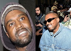 Kanye West pulled out all his real teeth, replaced them with new ones for 20 billion, and was immediately exposed for debt