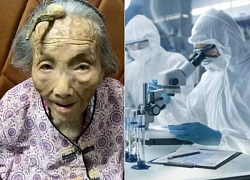 Strange: 107-year-old woman lives long thanks to growing horns on her forehead, science cannot explain?