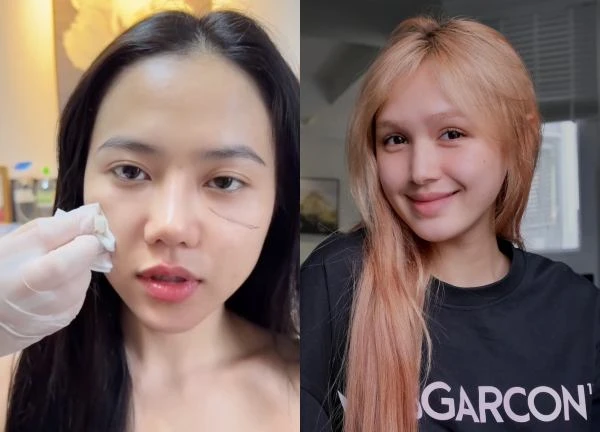 Xemesis' girlfriend admitted to having plastic surgery, was told to lose to Mango Non