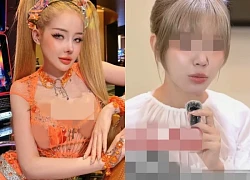 Ngan 98 reveals the reason for going to Korea for cosmetic surgery, "following" a female expert