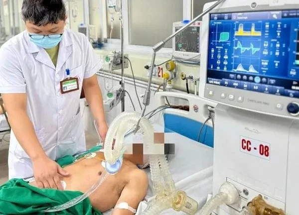 Mắc uốn ván từ khoang miệng