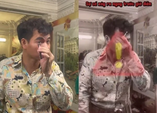 Cục trưởng Xuân Bắc gặp sự cố trước giờ diễn