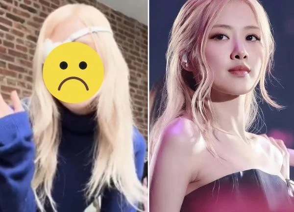 Rosé in unstable condition, eyes covered with bandages, trademark hair 'deformed'?