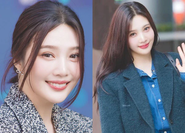 Joy (Red Velvet) thăng hạng nhan sắc nhờ 'dao kéo'