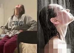 The girl was afraid of her sweat but couldn't shower for 7 years, and the doctor was also helpless