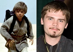 The child star "Star War" went for psychiatric treatment: The torment lasted for 10 months