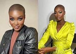 Miss Peace France: Bald beauty won the crown, extremely impressive beauty