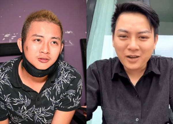 Hoai Lam revealed a haggard image and publicly announced that he had stopped singing due to a difficult illness