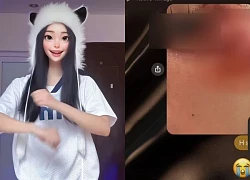 Quynh Bei revealed a photo of her face being scratched, her boyfriend was panicked and even more shocked when he learned the truth