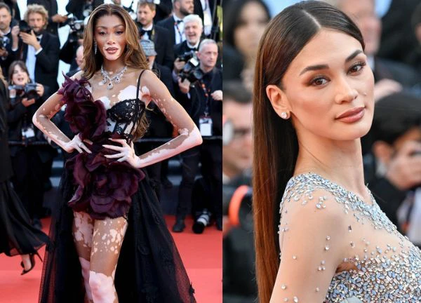 Siêu mẫu bạch biến càn quét thảm đỏ Cannes, Miss Universe 2015 lấy lại phong độ