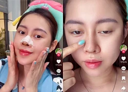 Viet Phuong Apply 3rd nose repair after silicone complications, revealing the amount of cutlery