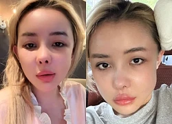 Ngan 98's face was deformed after plastic surgery, revealing a worrying condition.