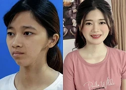 The girl transformed dramatically from "Thi No" to hot girl, her family couldn't recognize her