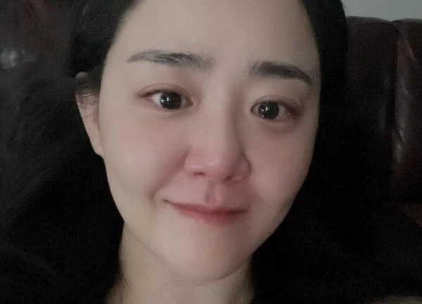 Sao Kpop 23/8: Diễn viên Trái tim mùa thu mệt mỏi, nhan sắc tụt dốc do bệnh tật