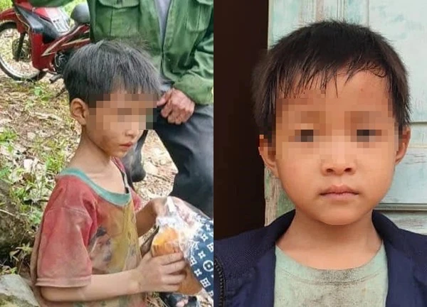 The case of a nephew lost in the forest in Yen Bai: Lost 4kg in 5 days, mother almost didn't recognize him
