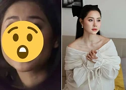 Tuong Vi's nose was deformed due to plastic surgery, but Ngan 98 still feels luckier?