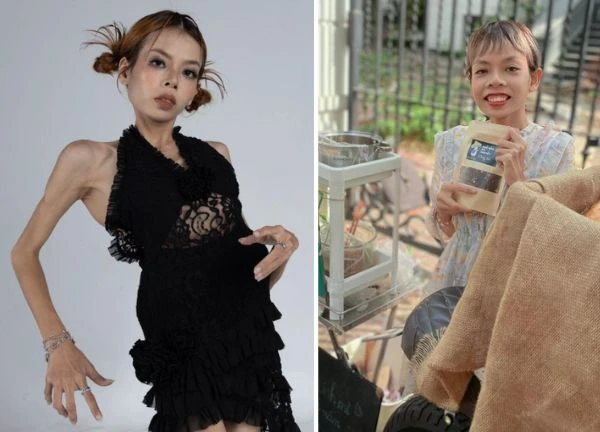 Ms. Cui was abandoned because of her body deformity, making a spectacular makeover that surprised netizens