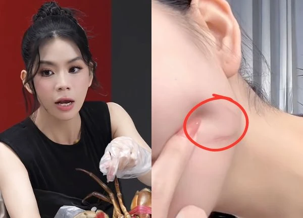 Hằng Du Mục show cận vết sẹo trên live, đáp trả lời tố makeup để câu thương hại