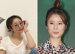 Ruby Lin has severe hair loss and deformed nose, suspected of being pregnant?