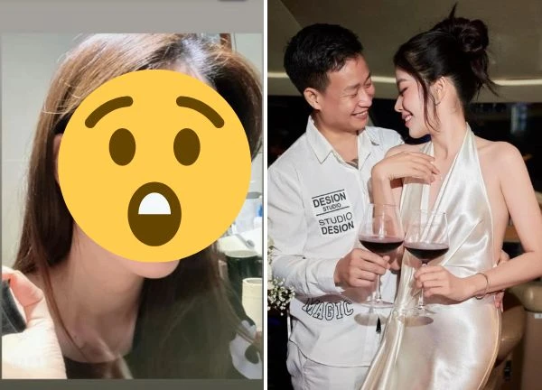 Nam Em 'sưng mắt' vì tình cũ, chia tay bị đòi nợ, nghi vấn phát 'bệnh tâm lý'?