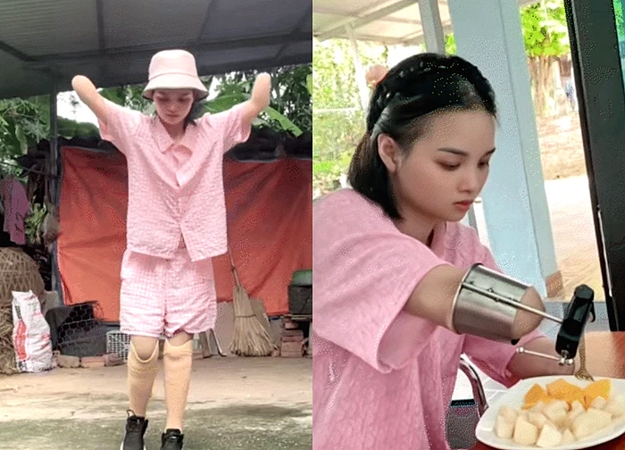 Nga Tích Cực - Kênh Tiktok của mẹ 2 con mất tứ chi sau cơn bạo bệnh: Kiên cường tập luyện với đôi chân "mới", ngày ngày livestream bán hàng nuôi con