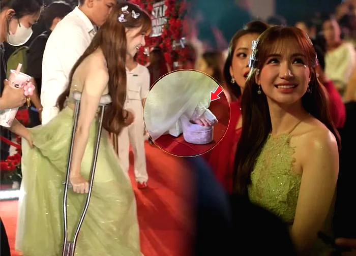 Hòa Minzy chống nạng, ngồi xe lăn đến sự kiện, lộ tình trạng sức khỏe báo động!