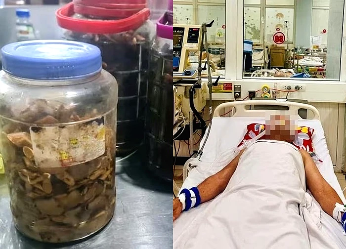 Thông tin mới vụ 6 người nguy kịch nghi uống rượu ngâm ở Nghệ An