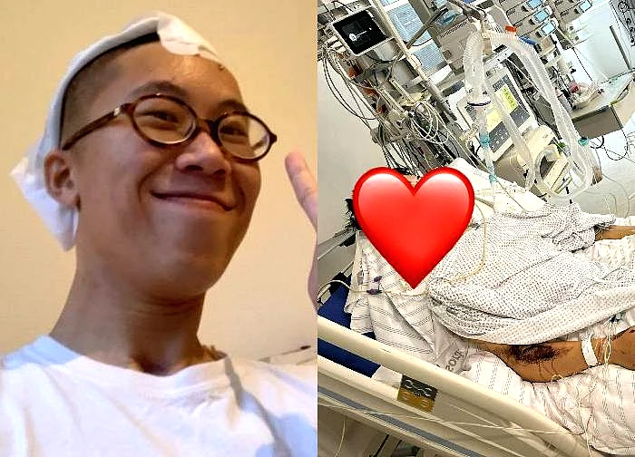 TikToker Bop tells for the first time about the horrific incident in Germany, waking up is a miracle