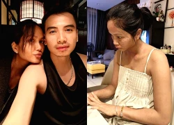 Hoa hậu H'Hen Niê sau khi bị biến dạng mặt