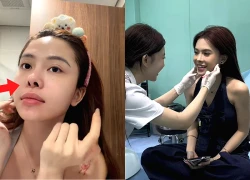 Hà Môi tiết lộ cái giá đau đớn của thẩm mỹ, mũi biến dạng khiến fan hoang mang