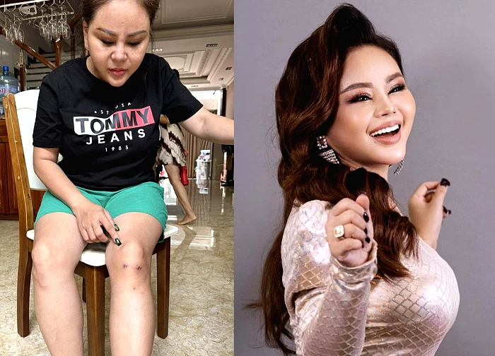 Le Giang fought alone with a strange disease, helpless, only knew how to crawl into the bathroom and cry.