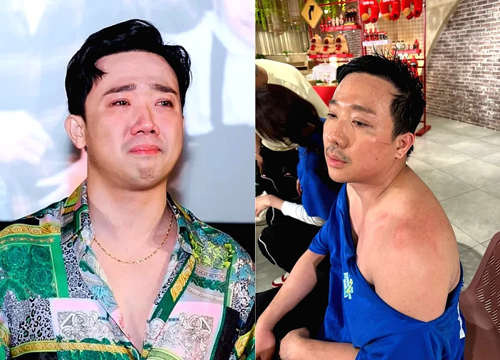 Tran Thanh "deteriorated" clearly, revealing a series of "signs" of labor that made fans confused