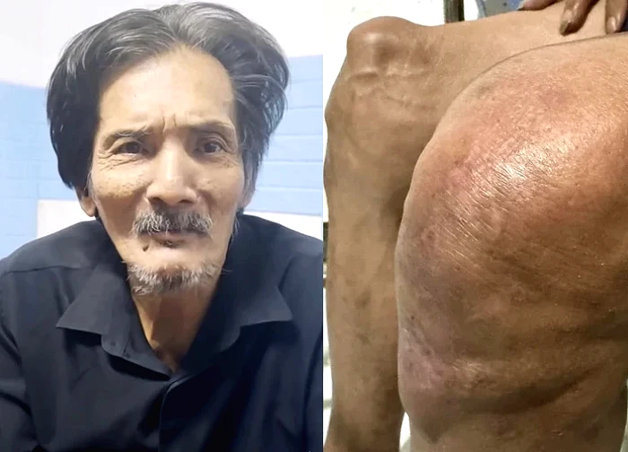 The "monstrous" disease made Thuong Tin exhausted and died, colleagues were "sad"