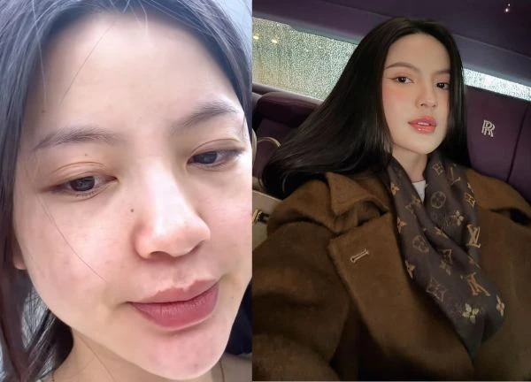 Quang Hai's wife revealed her true beauty without going through the app, surprised because of her dark spots, her face was full of acne