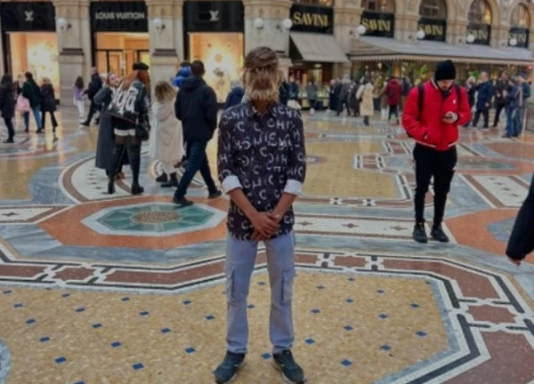 Chàng trai 18 tuổi lông mọc đầy mặt lập kỷ lục Guinness