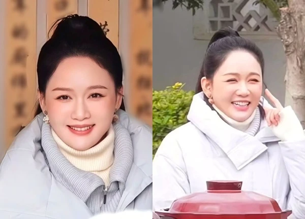 Hốt hoảng với gương mặt sưng vù, đơ như tượng sáp của Trần Kiều Ân