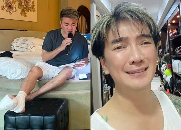 Dam Vinh Hung admits he has 4 missing toes, is embarrassed and doesn't dare to swim in the sea