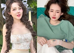 Ngan 98 canceled a series of shows, was hospitalized for emergency surgery for one reason, how is her health now?