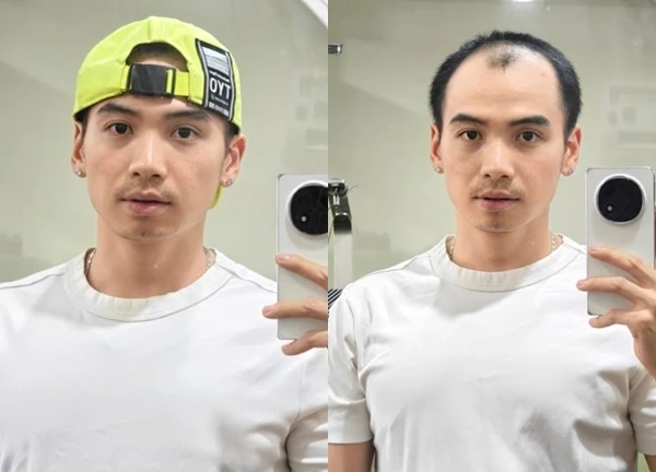 Chồng H'Hen Niê và cú tự khai gây bão