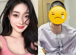 Famous model was "harmed" by her biological father, her face was burned and disfigured, netizens suspect a trick?