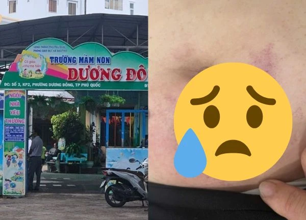 Vụ hiệu phó bị cấp dưới 'tẩn' bầm tím: bị hại nắm bí mật sốc của người ra tay?